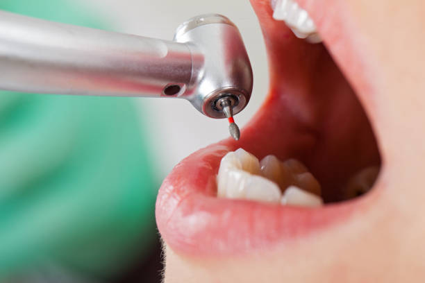 Best Pediatric Emergency Dentist in Cortland West, NY